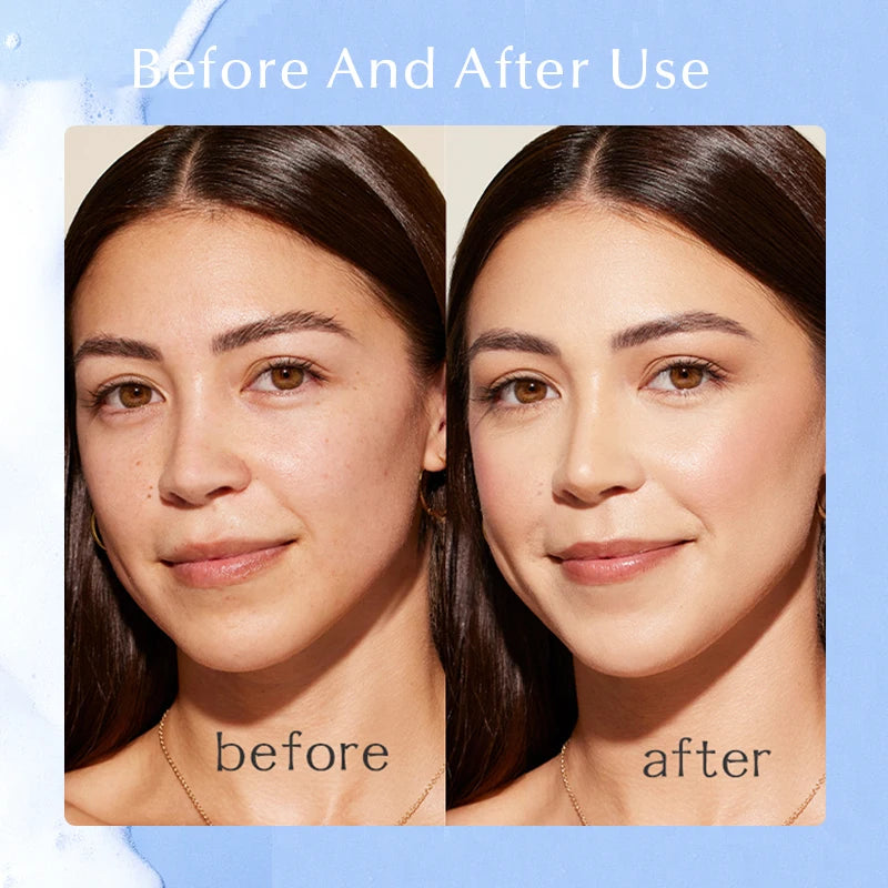 ALIDINA Salicylic Acid Cleanser 100G