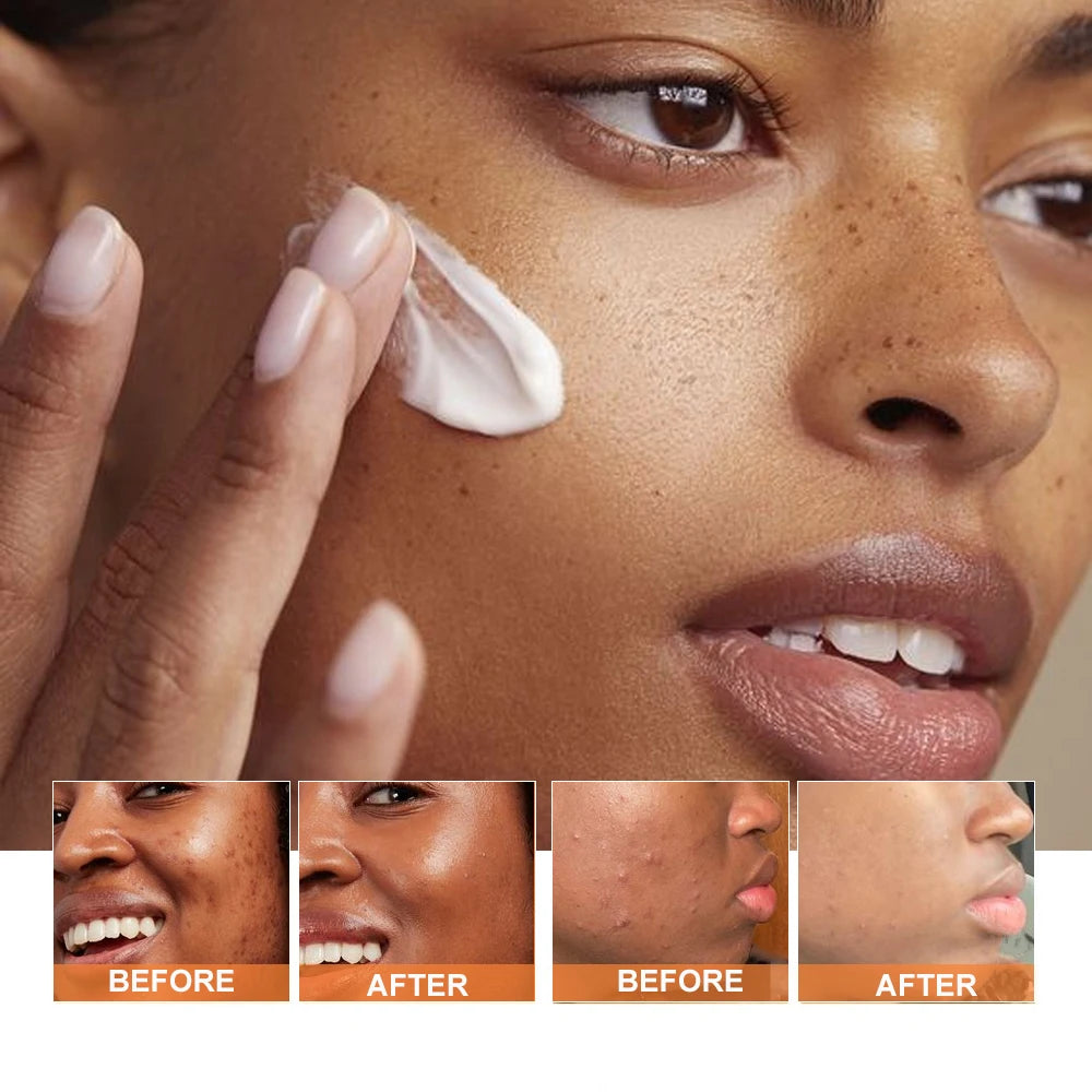 Vegan Turmeric Facial Cream Mask