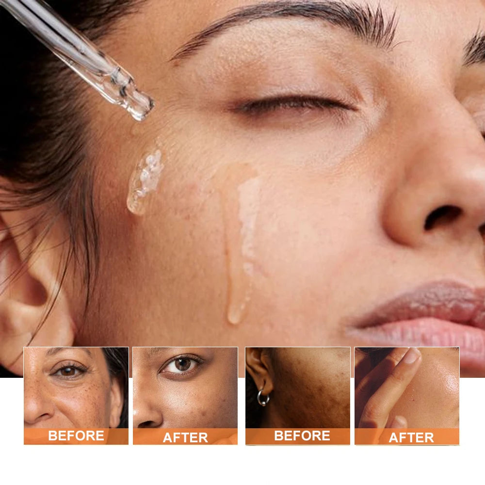 PHISYA Vegan Turmeric Face Oil