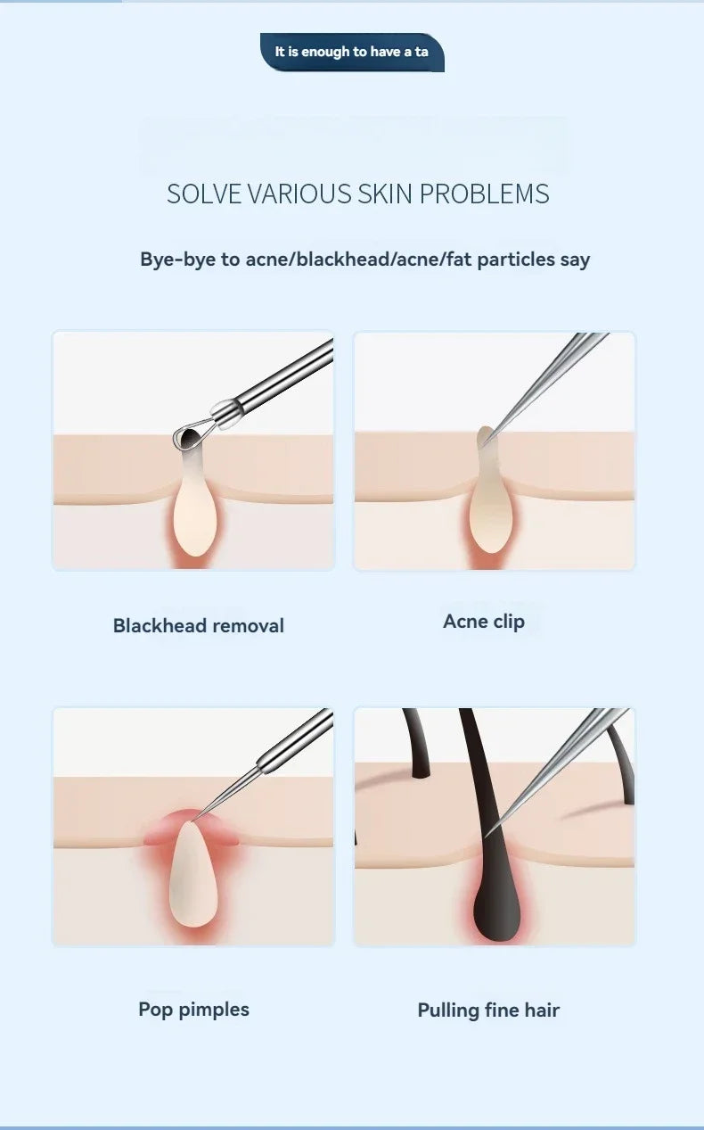 YJYIBEI 11Pcs/Set Acne Needle Blackhead Clip Remover