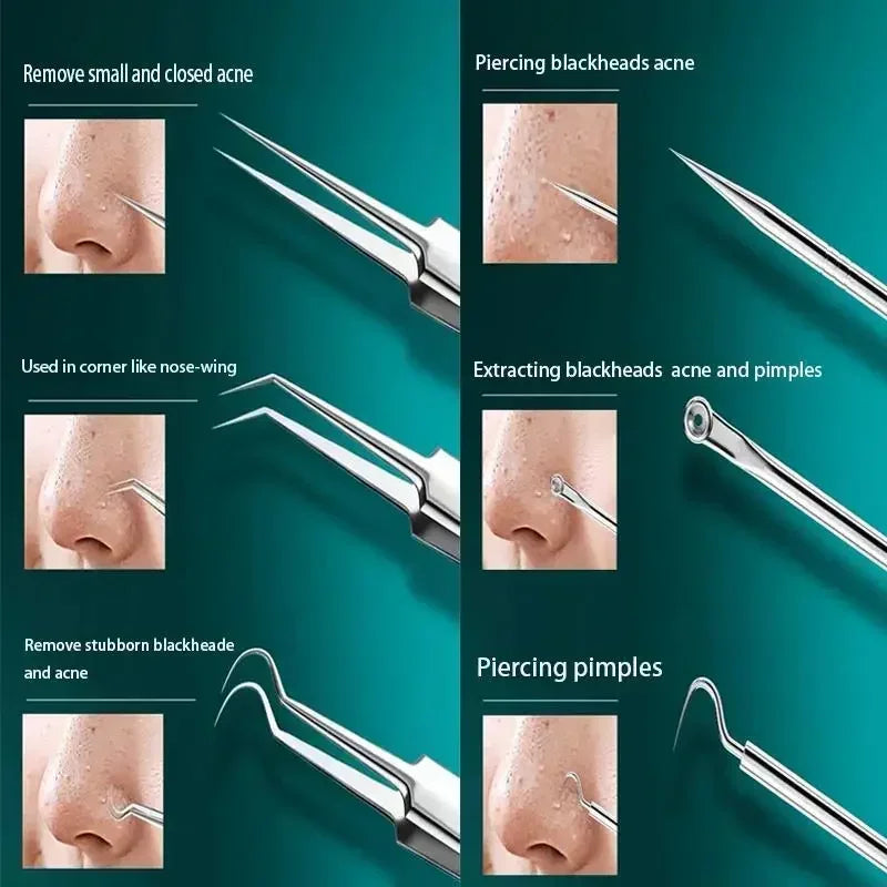 YJYIBEI 11Pcs/Set Acne Needle Blackhead Clip Remover