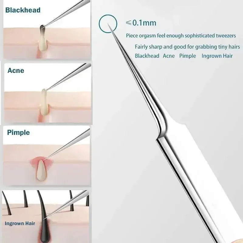 YJYIBEI 11Pcs/Set Acne Needle Blackhead Clip Remover